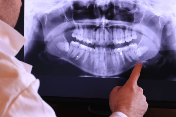 Best Weekend Emergency Dentist in Stony Point, NC