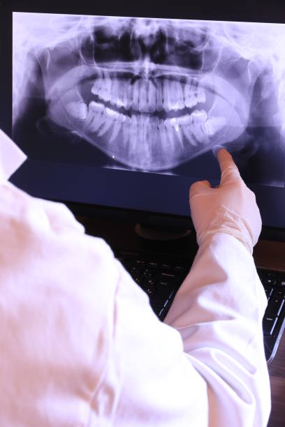 Best Emergency Dentist for Knocked-Out Tooth in Stony Point, NC